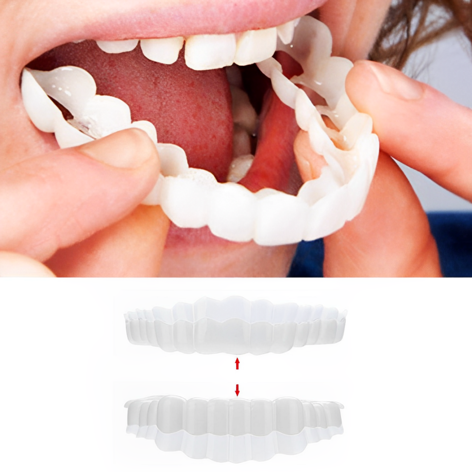 Snap on Veneers Cosmetic Dental Temporary Tooth Covers Upper and Lower Set - Image 1
